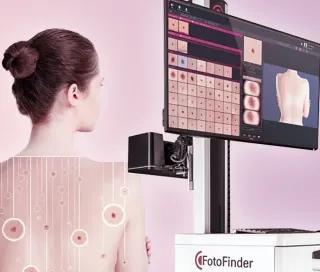 tehnologie foto finder la DermaLife
