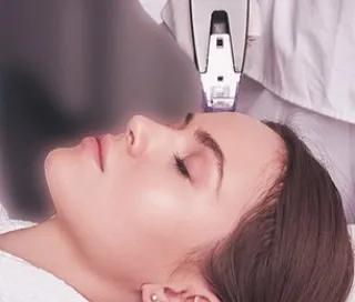 Morpheus8 cea mai noua tehnologie de radiofrecventa & microneedling din lume