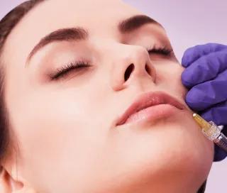 Marirea buzelor cu Acid Hialuronic la DermaLife