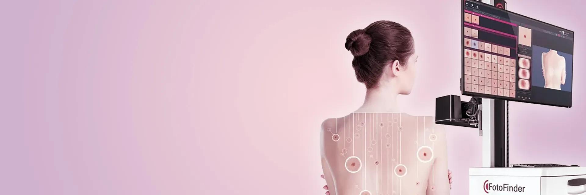 tehnologie foto finder la DermaLife